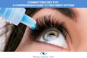 Combatting Dry Eye A Comprehensive Guide to Treatment Options